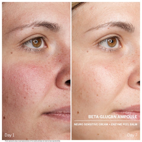 POWER SERUM AMPOULE: BETA GLUCAN